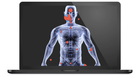 TIBCO SPOTFIRE Fig 02 Mapping the human body